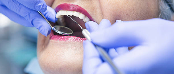 Best Emergency Root Canal Treatment in East Hills, NY